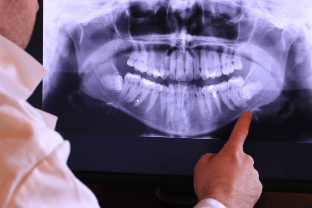 Best Emergency Treatment for Dental Infections or Abscesses in Brookfield, WI